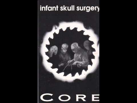 Infant skull Surgery - Genocide