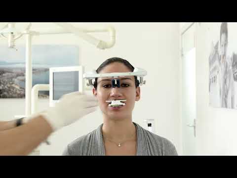 Advanced Registration with the digital facebow Zebris for Ceramill