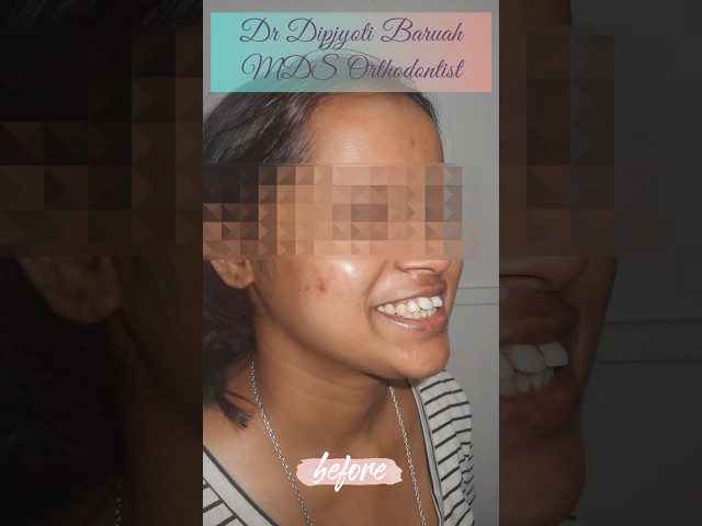 Thumbnail for Post ID: EcrunBpuXAU