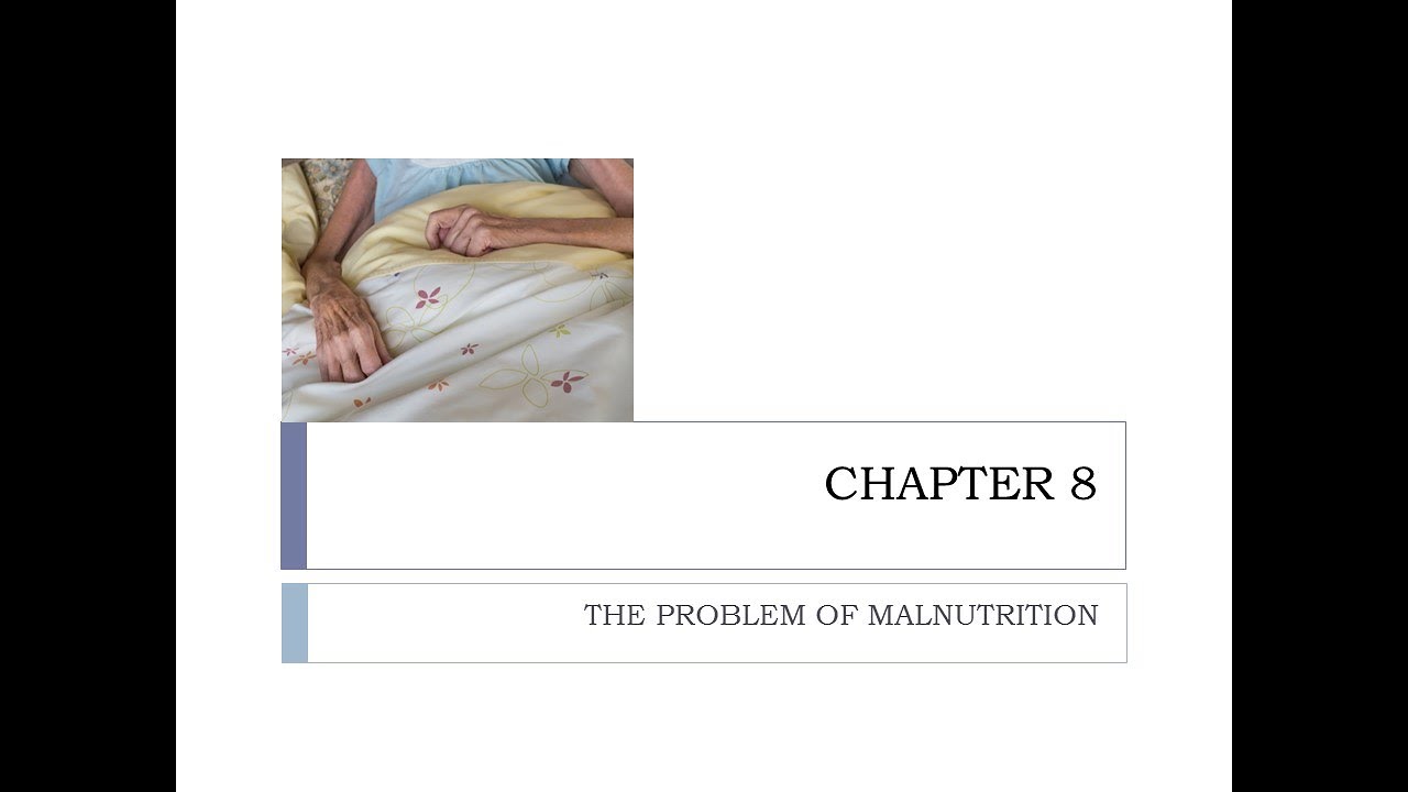 MALNUTRITION-1 ASSESSMENT F2023