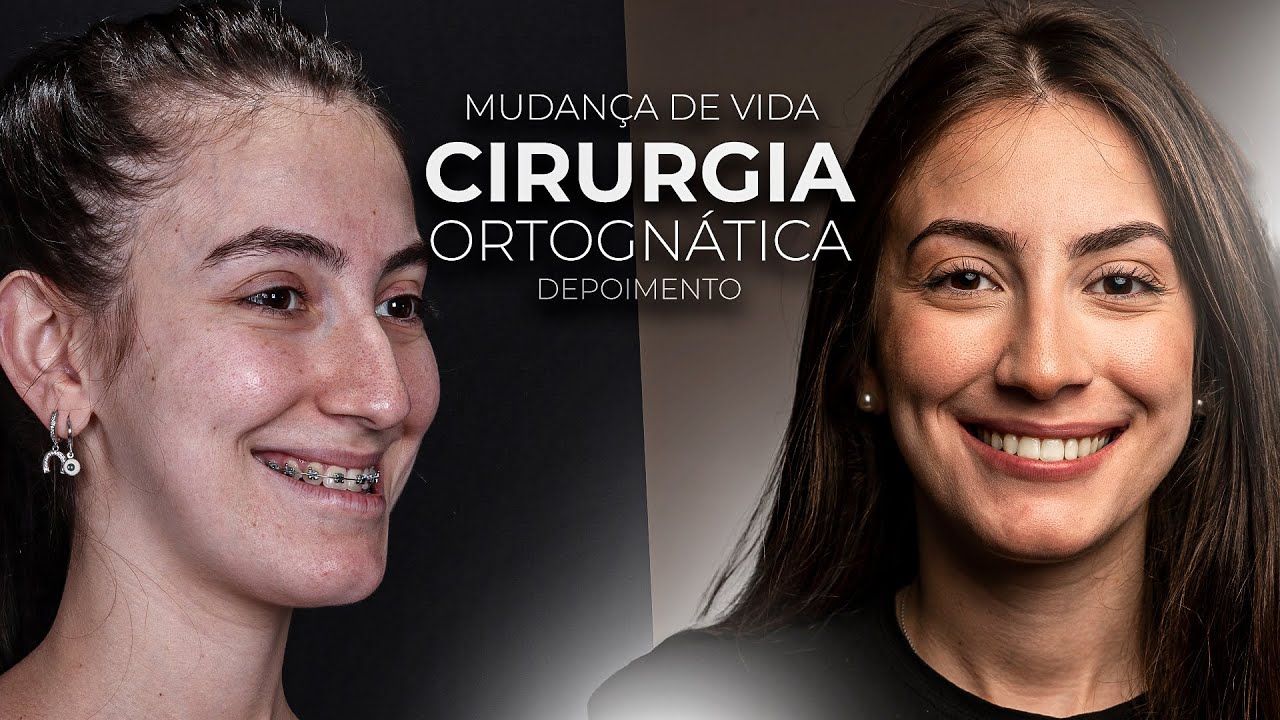 João Pedro Paulino Mazzon-76