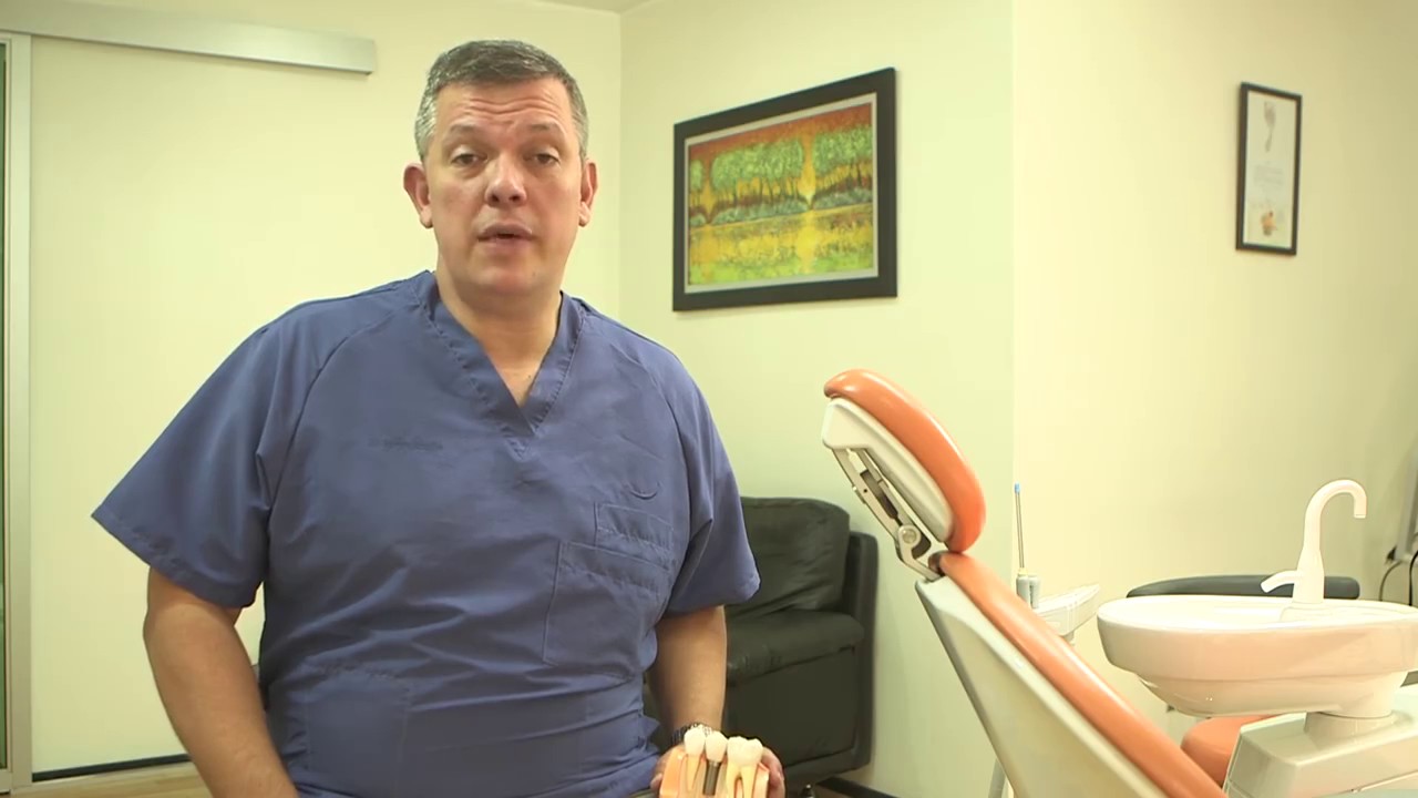 Dental implants