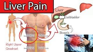 Liver Pain? - Right upper abdominal pain. Right upper quadrant pain