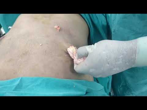 Patient Recovery Case — Video 38 (Clinical Testimonial)
