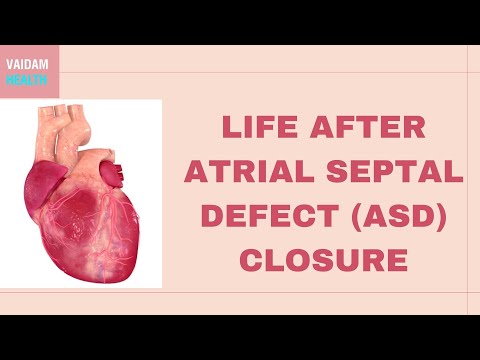 How ASD Affects the Heart During Exercise