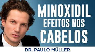 Qual Efeito Do Minoxidil Nos Cabelos? – Dr. Paulo Müller Dermatologista.