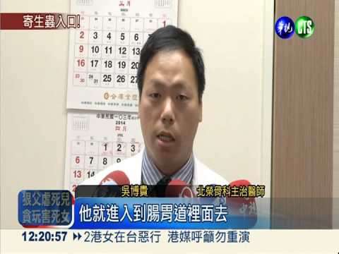 童吃未熟烤肉 弓漿蟲感染骨髓炎