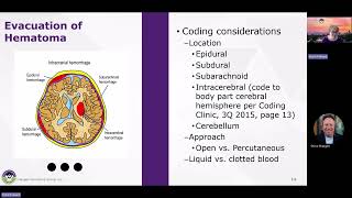HCGTV: Webinar Snippet - ICD-10-PCS Evacuation of Hematoma