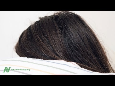 Eczema allergico su un trattamento di faccia Cura della pelle del bambino con eczema