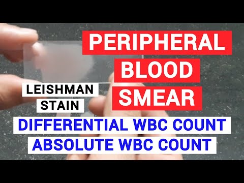 PERIPHERAL BLOOD SMEAR | HAEMATOLOGY LAB | PHYSIOLOGY PRACTICALS