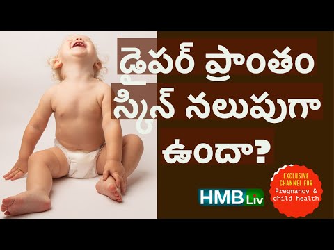 డైపర్ వేసే ప్రాంతం నల్లగా ఎందుకు అవుతుంది? diaper care tips for skin