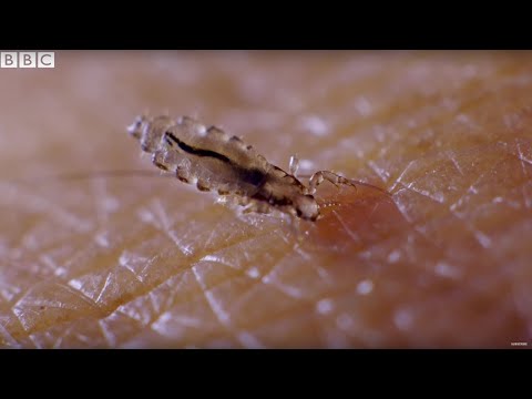 helmint paraziták hogyan kell kezelni petefészekrák röntgen