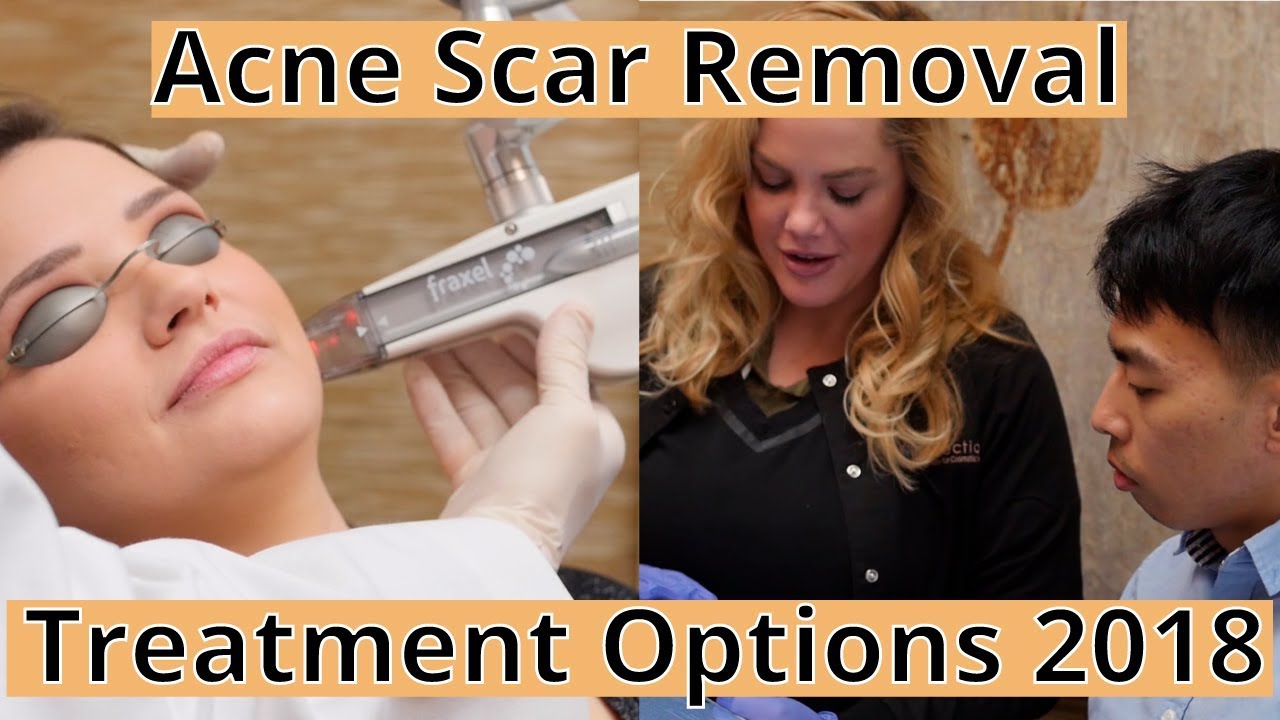 Acne Scar Removal Options: What's New & What Works with Dr. Ellern