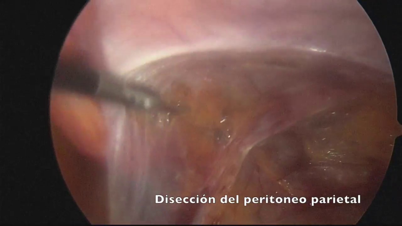 Olliver Núñez Cantú-13