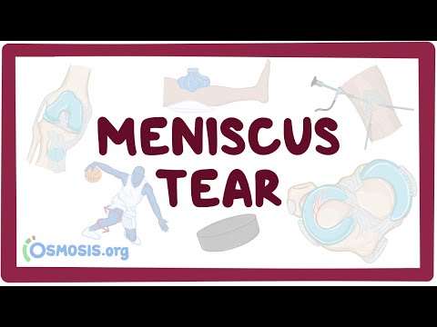 misha kenőcs ízületekre