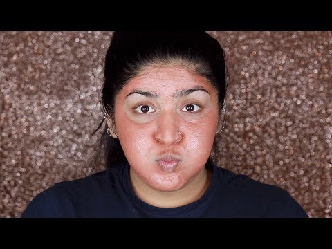 10 Face Masks/Packs For Acne & Acne Prone Skin | All Budgets and Skin Types | Shreya Jain