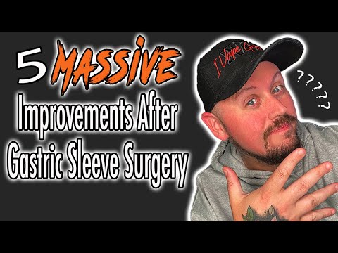 5 MASSIVE Improvements After Gastric Sleeve Surgery! MUST WATCH!