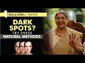 How to Remove Dark Spots from Face Naturally at Home | Home Remedies to Remove Dark Spot | Skin Care