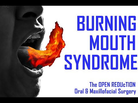 Burning Mouth Syndrome | How To Diagnose And Treat