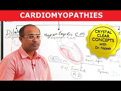 Cardiomyopathies - Causes & Symptoms - Cardiology