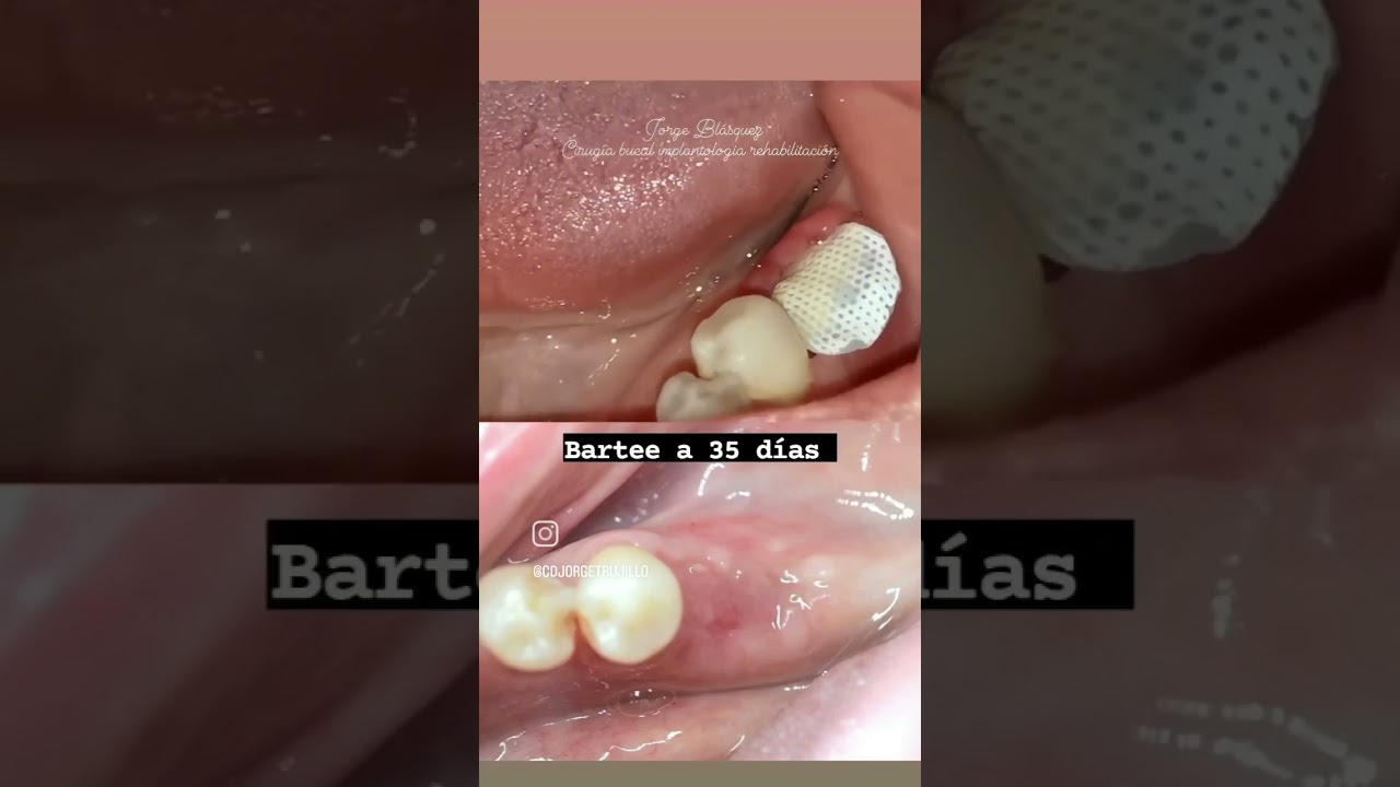 Jorge Luis Trujillo Blásquez-15