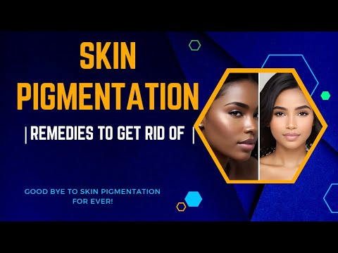 How To Remove Pigmentation From Face Permanently At Home | How to get rid of Skin Pigmentation |