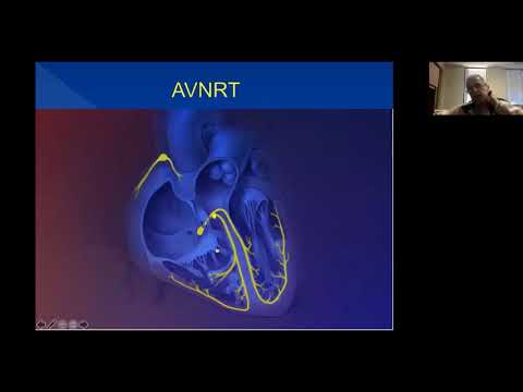 Cardiac Anatomy for the EP World - Pt 2