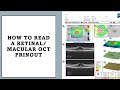 HOW TO READ MACULAR OCT PRINTOUT? made easy!!
