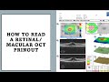 HOW TO READ MACULAR OCT PRINTOUT Made Easy
