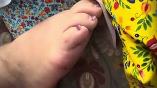 My grandmas feet (reupload)