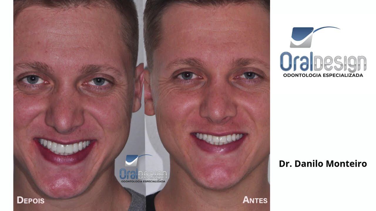 Danilo Monteiro Rezende Pereira-43