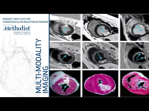 Latest Advances in CMR Techniques and Future Applications (DIPAN J. SHAH, MD) May 21, 2019