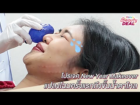โบท็อก ปีกจมูก