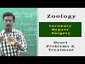 Zoology Human Body What Is Bypass Surgery Blood Pressure Heart Block Cure