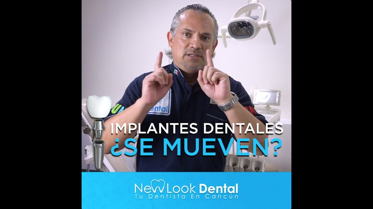 ¿Qué significa que un IMPLANTE se mueva / Te responde un dentista 🦷