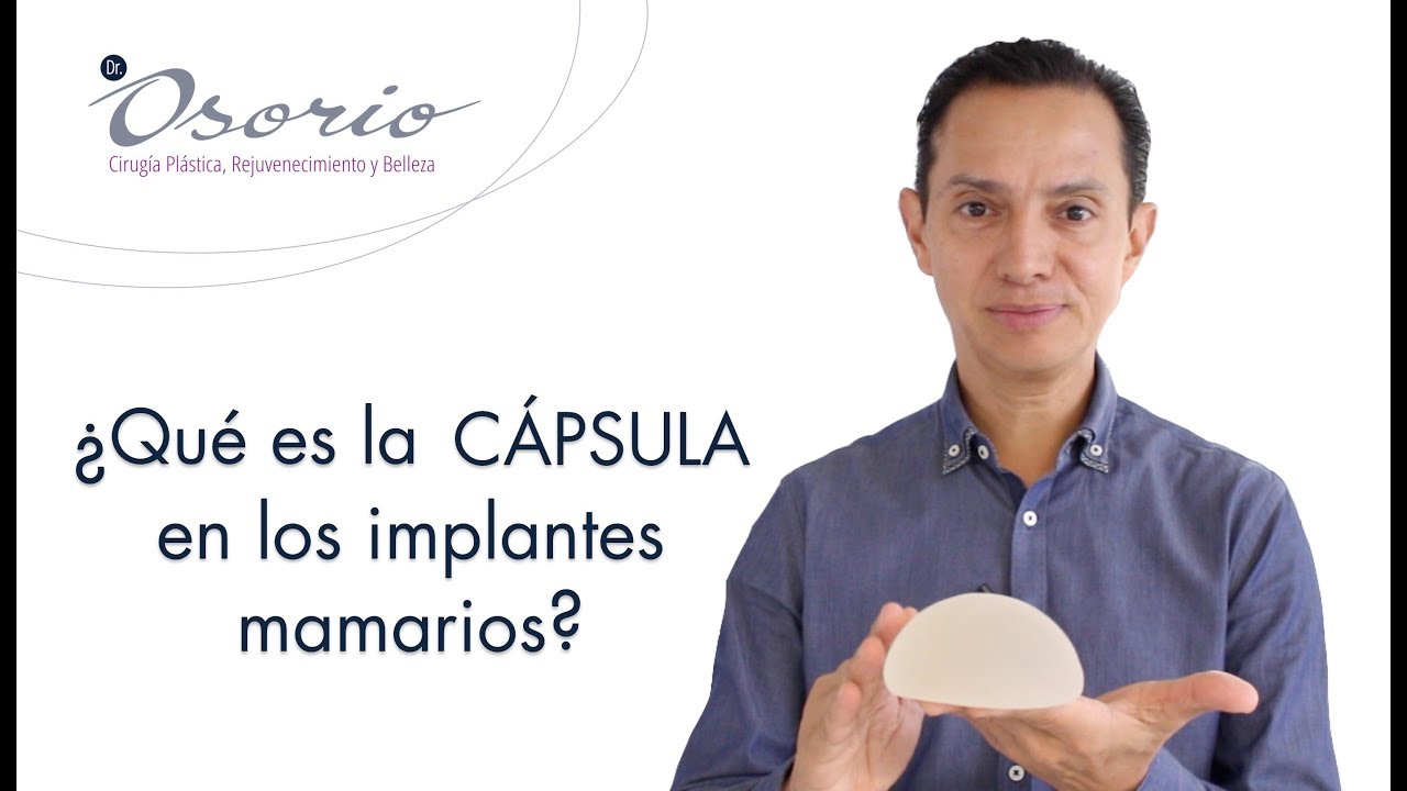 ¿QUÉ ES LA CÁPSULA EN LOS IMPLANTES MAMARIOS?