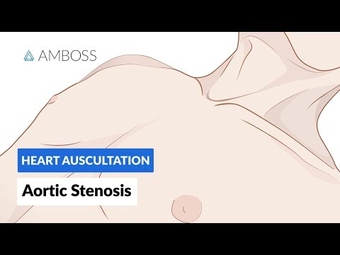 Aortic Stenosis (AS) - Heart Auscultation - Episode 1