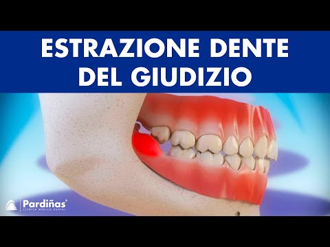 Dolore al collo e la temperatura muscolare Temperatura legamenti della caviglia rottura