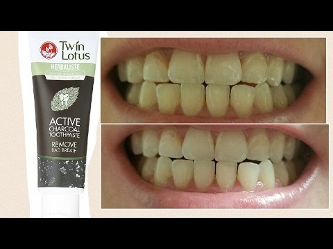 Twin Lotus Active Charcoal Toothpaste! It really works!