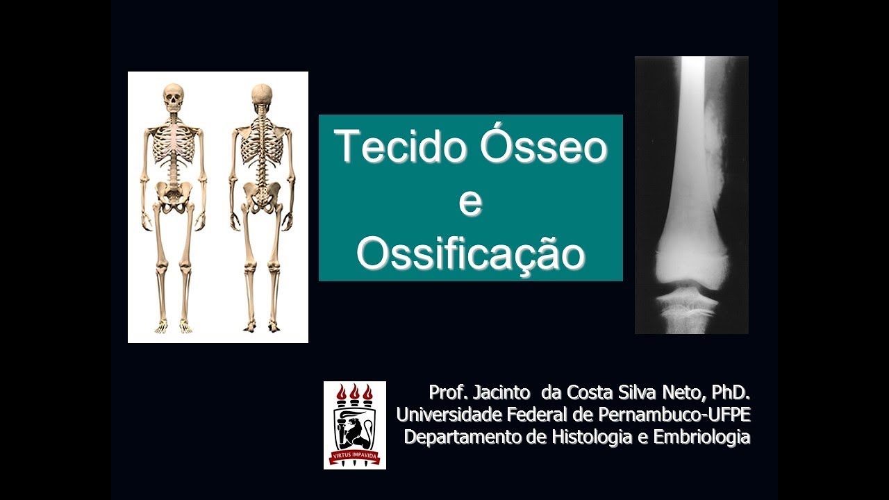 6-Tecido Ósseo e Ossificação - Nível de Graduação