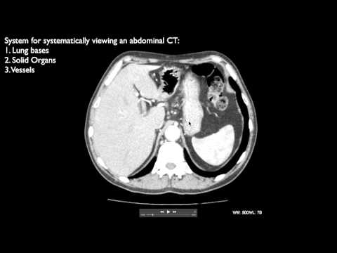 How to interpret an abdominal CT