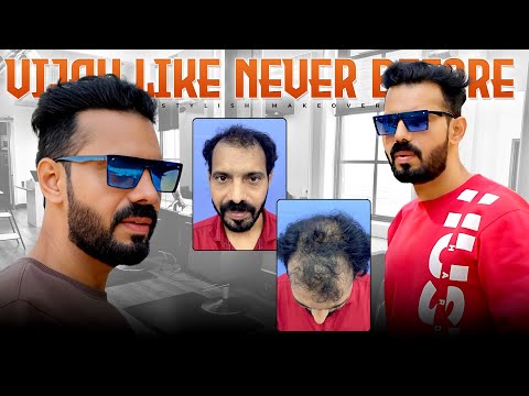 #AskDrJohnWatts | VIJAY like NEVER before Stylish Makeover | Hair Specialist Explains
