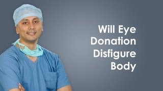 Will eye donation disfigure body? 