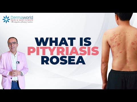 How to get rid of red rashes on the skin? | Symptoms Aur Treatment Explained |