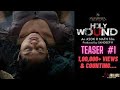 Teaser