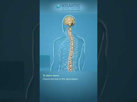 What is Cervical Lateral Stenosis? #Shorts