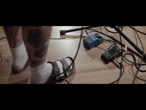 Akne Kid Joe - 99% Live-Session (live at lala studios)