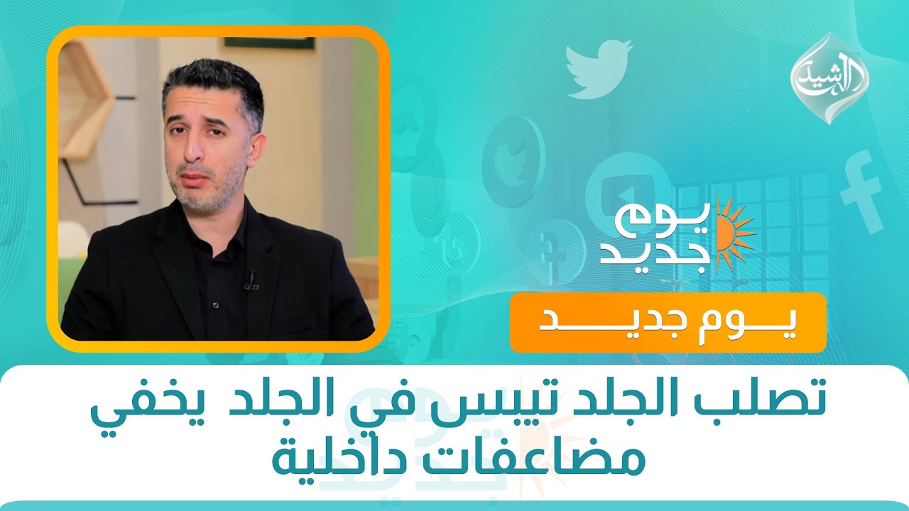 فيديو | صحتكم || تصلب الجلد تيبس في الجلد  يخفي مضاعفات داخلية مع الدكتور محمد عادل الهاشمي
