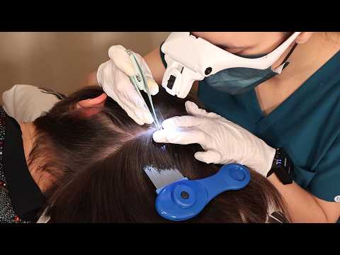 ASMR School Nurse LICE Check on SCALP | Lices Removal & Detailed Exam