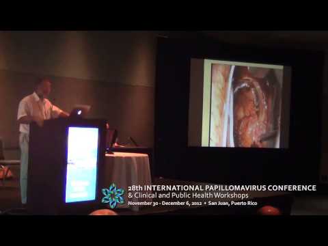 Management of High-Grade Cervical Cytology and Histology (HSIL, CIN 2,3) by Walter Prendiville